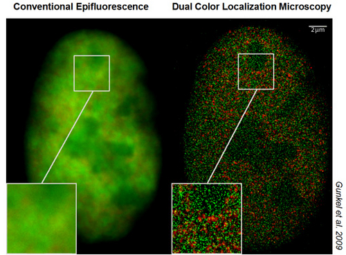 Superresolution microscopy The difference between conventional and superresolution microscopy